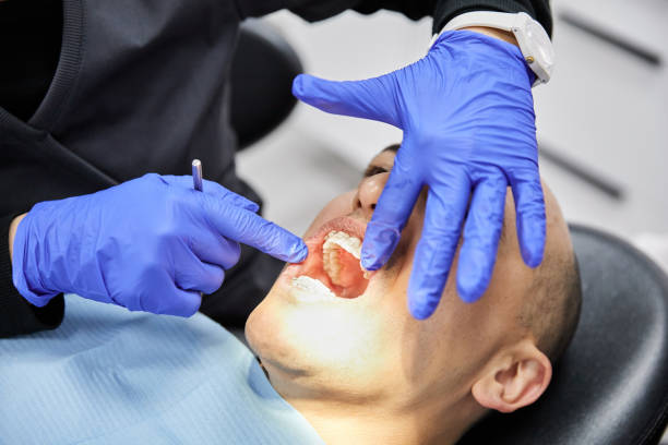 Best Emergency Treatment for Dental Infections or Abscesses in University, FL